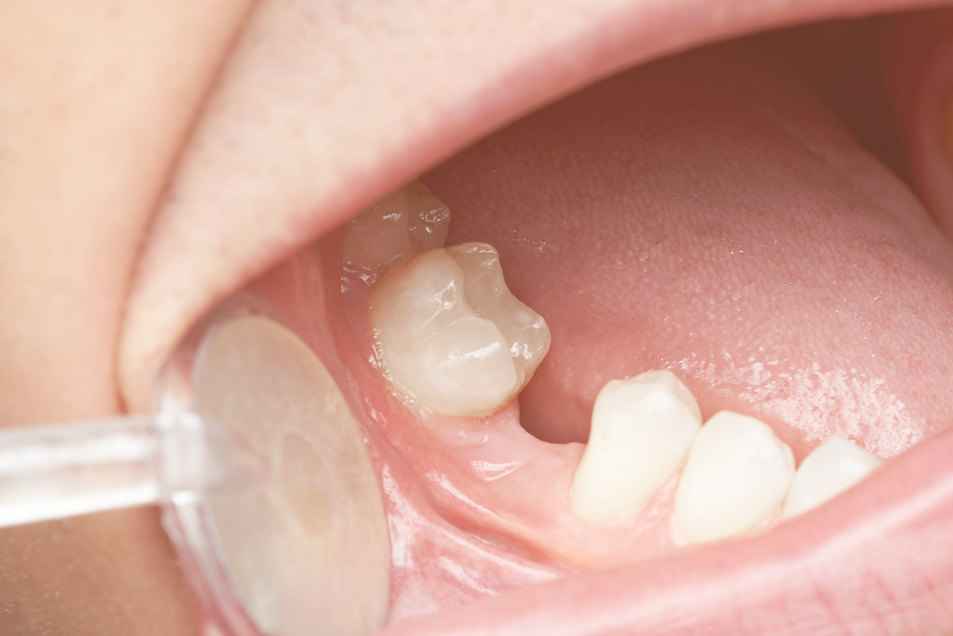 Whole Life Dental Whole Life Dental