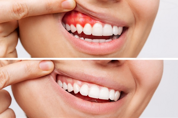 Whole Life Dental Whole Life Dental