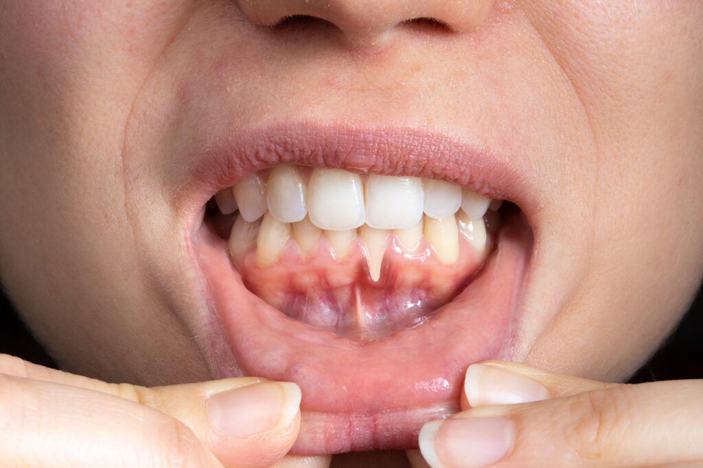 Whole Life Dental Whole Life Dental